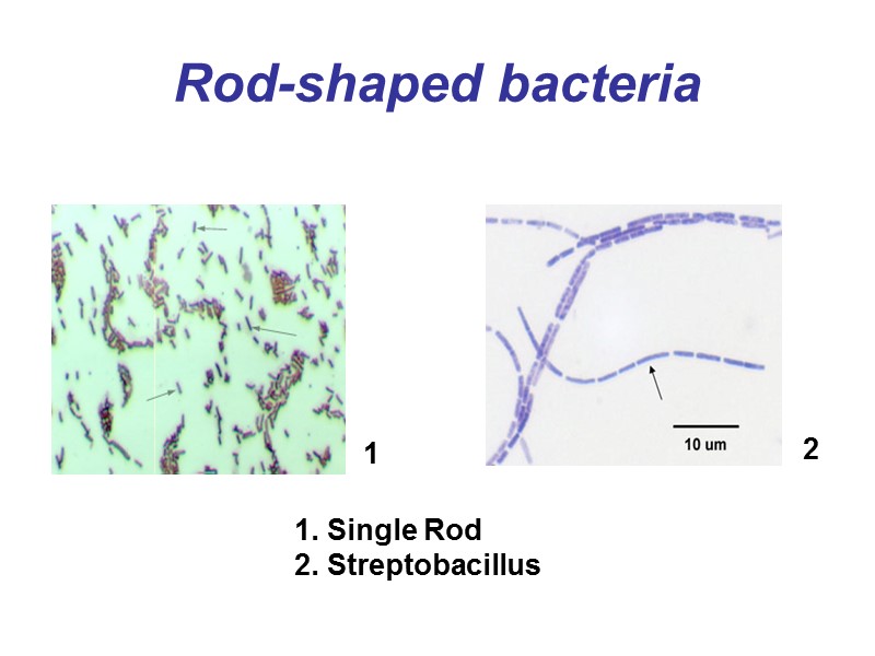 Rod-shaped bacteria  Single Rod  Streptobacillus  1 2